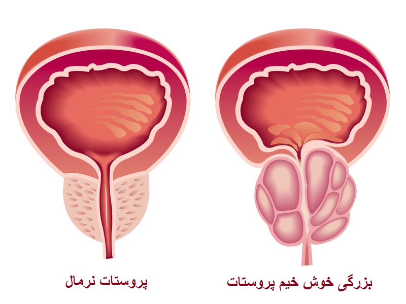 خواص نخل اره ای