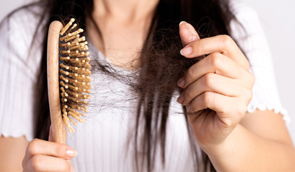  ماینوکسیدیل چیست چه اثری در ریزش مو دارد؟