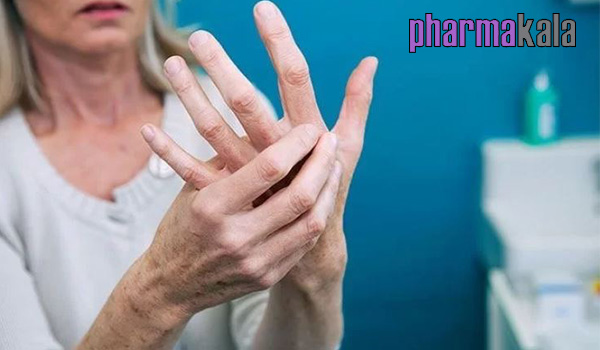همه چیز در مورد آرتروز