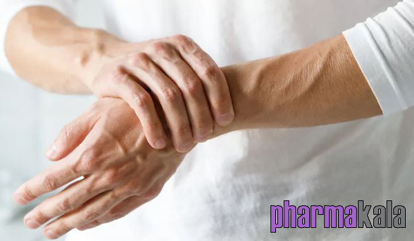 همه چیز در مورد آرتروز