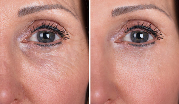 رتینول چیست و چه کاربردی دارد؟ retinol رتینول