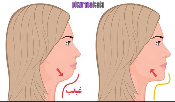 معرفی 10 روش ساده رفع غبغب معرفی 10 روش ساده رفع غبغب