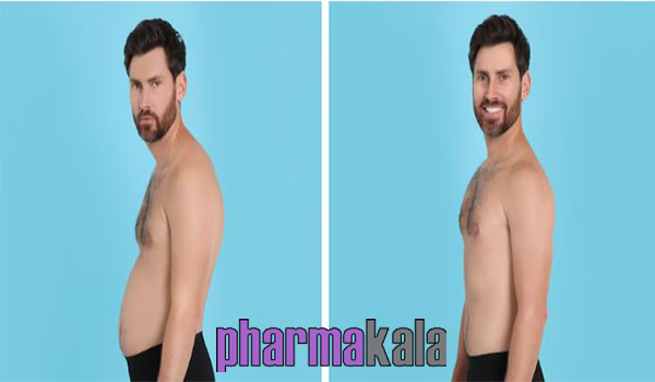 ابدومینوپلاستی چیست؟