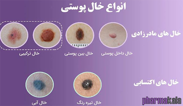 همه چیز در مورد برداشت خال همه چیز در مورد برداشت خال
