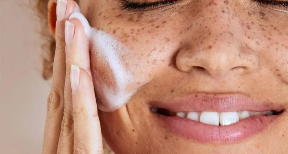 معرفی 10 بهترین درمان خانگی لک قهوه ای صورت