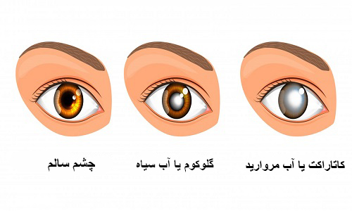 10 بهترین مکمل چشم و بینایی 10 بهترین مکمل های چشم و بینایی
