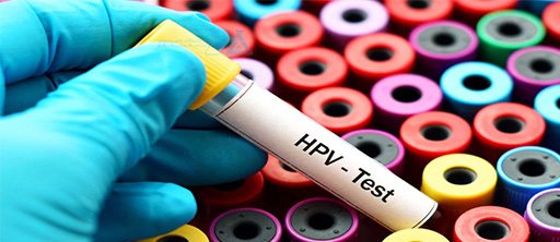 اچ پی وی (HPV) چیست؟ اچ پی وی (HPV) چیست؟