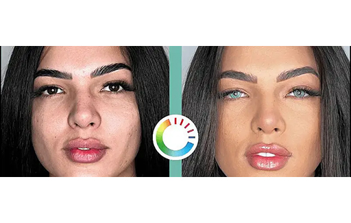 همه چیز درباره عمل تغییر رنگ چشم