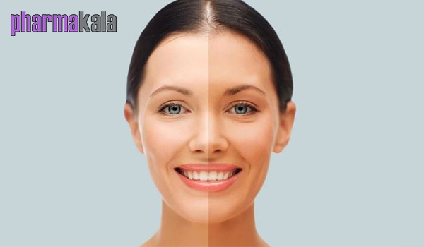 چگونه پوست را روشن تر کنیم؟