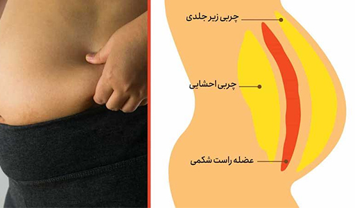 چربی شکم چگونه آب میشود چربی شکم چگونه آب میشود