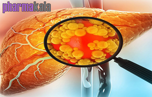 تغذیه مناسب برای کبد چرب