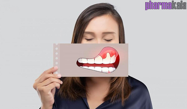 بهترین کپسول برای عفونت دندان