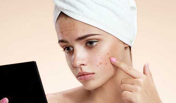 چرا بعضی ویتامینها باعث جوش صورت میشوند؟ چرا بعضی ویتامینها باعث جوش صورت میشوند؟