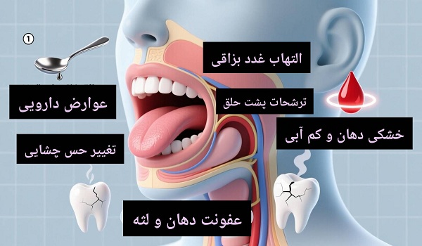 علت شوری دهان چیست؟ ۱۰ علت شایع + راههای رفع و درمان خانگی علت شوری دهان 3