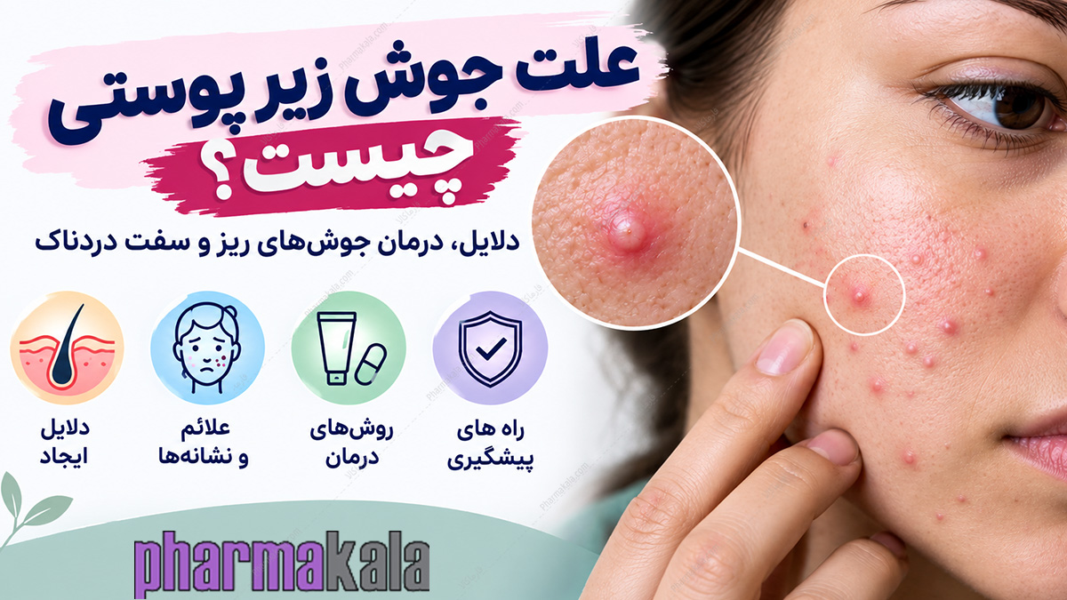 علت جوش زیر پوستی چیست؟ دلایل، درمان جوشهای ریز و سفت دردناک علت جوش زیر پوستی چیست؟ دلایل، درمان جوشهای ریز و سفت دردناک