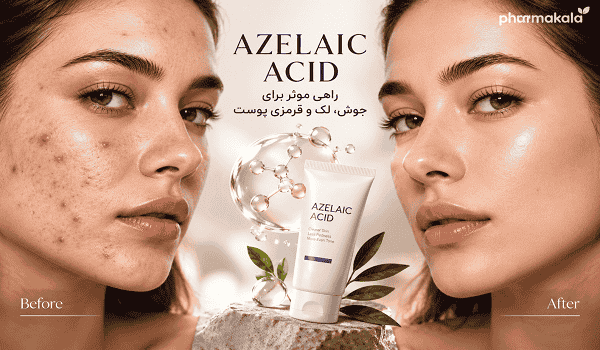 آزلائیک اسید چیست؟ ۱۰ کاربرد، فواید و عوارض آزلائیک اسید برای جوش، لک و قرمزی پوست آزلائیک اسید چیست؟
