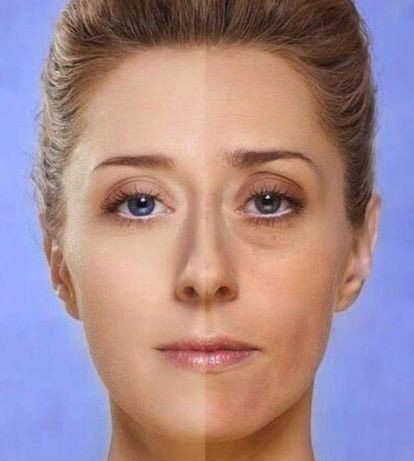 ماسک صورت خانگی رفع جوش ماسک برای پوست های خشک و رفع لک های پوستی
