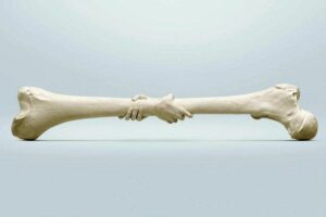 علائم کمبود کلسیم و پوکی استخوان