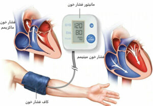 همه چیز درباره فشار خون بالا چگونگی اندازه گیری فشارخون