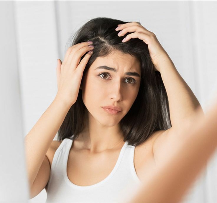 علائم و نشانه های شوره سر