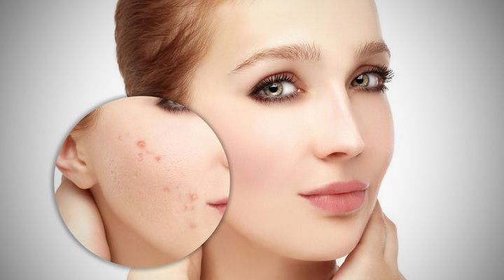 لیکوپن چست و در چه مواد غذایی وجود دارد؟ خواص لیکوپن برای پوست